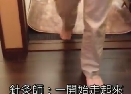 冨田祥史醫案-多重系統退化症治療後