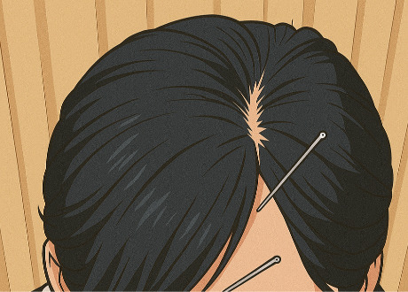 43歲女性-多發性硬化症